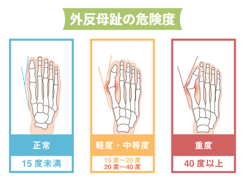 整体Se-bone LAND 中目黒 肩こり 腰痛 頭痛 姿勢 骨盤 目黒区 都内 東京 膝痛 脊柱管狭窄症 ヘルニア 捻挫 歪み 個室 根本治療 外反母趾 巻き爪